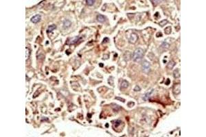 Immunohistochemistry (IHC) image for anti-Activin Receptor Type I (ACRV1) (AA 132-162) antibody (ABIN3029855)
