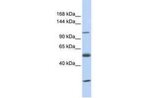 Image no. 1 for anti-Solute Carrier Family 39 (Zinc Transporter), Member 10 (SLC39A10) (AA 36-85) antibody (ABIN6743224) (SLC39A10 Antikörper  (AA 36-85))