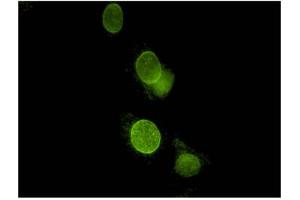 Image no. 1 for anti-Spectrin Repeat Containing, Nuclear Envelope 2 (SYNE2) antibody (ABIN1042629)