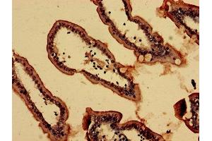 Immunohistochemistry analysis of human small intestine tissue using ABIN7161975 at dilution of 1:100 (NOL4L (AA 101-300) Antikörper)