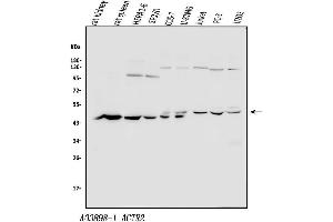 Western blot analysis of Arp2/ACTR2 using anti-Arp2/ACTR2 antibody (ABIN7599349).