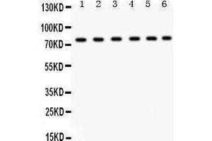 Western Blotting (WB) image for anti-Transient Receptor Potential Cation Channel, Subfamily V, Member 5 (TRPV5) (AA 580-610), (C-Term) antibody (ABIN3043496) (TRPV5 Antikörper  (C-Term))