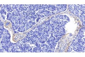 Immunohistochemistry (IHC) image for anti-Elastin (ELN) (AA 392-645) antibody (ABIN7433489)