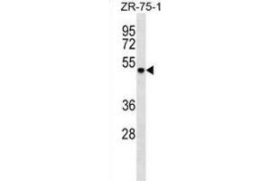 Western Blotting (WB) image for anti-DEAD (Asp-Glu-Ala-Asp) Box Polypeptide 6 (DDX6) antibody (ABIN2999135) (DDX6 Antikörper)