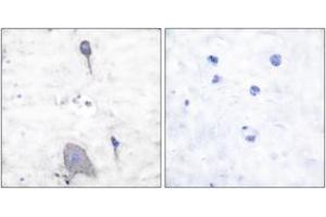 Immunohistochemistry analysis of paraffin-embedded human brain tissue, using Sirp alpha1 Antibody. (SIRPA Antikörper  (AA 451-500))