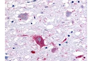 Immunohistochemical staining of Brain (Neurons and glia) using anti- GPR32 antibody ABIN122142 (GPR32 Antikörper)