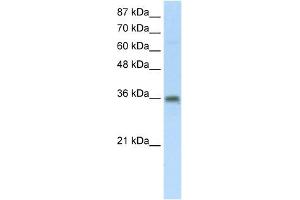 SFRS10 antibody used at 5 ug/ml to detect target protein. (TRA2B Antikörper)