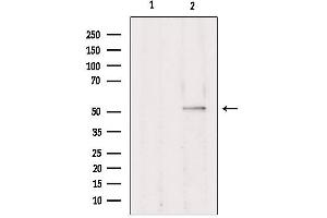 Western blot analysis of extracts from Hepg2, using TRIM38 Antibody. (TRIM38 Antikörper  (Internal Region))