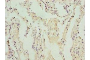 Immunohistochemistry of paraffin-embedded human lung tissue using ABIN7171726 at dilution of 1:100 (ZBTB48 Antikörper  (AA 1-280))
