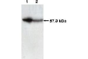 Western Blotting (WB) image for anti-Chaperonin Containing TCP1, Subunit 2 (Beta) (CCT2) (C-Term) antibody (ABIN264513)
