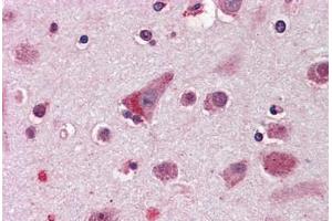 Anti-ELOVL5 antibody  ABIN960769 IHC staining of human brain, cortex. (ELOVL5 Antikörper  (Internal Region))