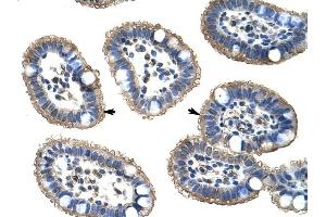 Immunohistochemistry (IHC) image for anti-Nudix (Nucleoside Diphosphate Linked Moiety X)-Type Motif 21 (NUDT21) antibody (ABIN630019)
