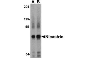 Western Blotting (WB) image for anti-Nicastrin (NCSTN) (Middle Region) antibody (ABIN1031014) (Nicastrin Antikörper  (Middle Region))