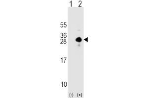 Western Blotting (WB) image for anti-Sclerostin (SOST) antibody (ABIN2912280) (Sclerostin Antikörper)