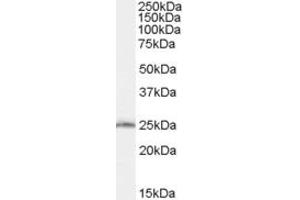 Western Blotting (WB) image for anti-SAR1 Homolog B (SAR1B) (AA 104-116) antibody (ABIN292166) (SAR1B Antikörper  (AA 104-116))