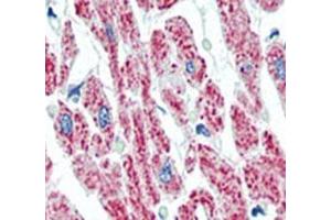 IHC analysis of FFPE human heart tissue stained with Aconitase 2 antibody. (ACO2 Antikörper  (AA 438-467))