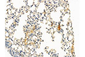 ABIN7093259 and ABIN7097276 at 1/100 staining Mouse lung tissue by IHC-P. (IL2 Receptor beta Antikörper  (pTyr364))