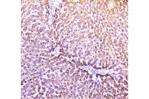 IHC analysis of PON1 using anti-PON1 antibody (ABIN6719356).