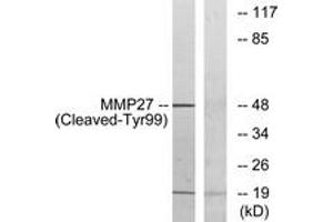 Western Blotting (WB) image for anti-Matrix Metallopeptidase 27 (MMP27) (AA 80-129), (Cleaved-Tyr99) antibody (ABIN2891209) (MMP27 Antikörper  (Cleaved-Tyr99))