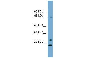 WB Suggested Anti-ZNF37A Antibody Titration:  0. (ZNF37A Antikörper  (Middle Region))