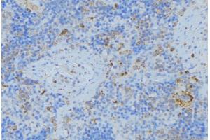 ABIN6276774 at 1/100 staining Human lymph node tissue by IHC-P.