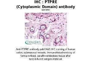 Image no. 1 for anti-Protein tyrosine Phosphatase, Receptor Type, E (PTPRE) (Cytoplasmic Domain) antibody (ABIN1738608) (PTPRE Antikörper  (Cytoplasmic Domain))