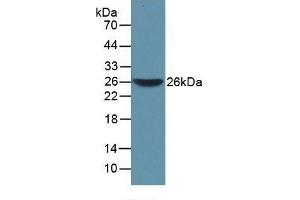 Detection of Recombinant WARS, Mouse using Polyclonal Antibody to Tryptophanyl tRNA Synthetase (WARS) (WARS Antikörper  (AA 29-195))