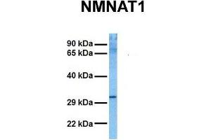 Host:  Rabbit  Target Name:  NMNAT1  Sample Tissue:  Human HCT116  Antibody Dilution:  1. (NMNAT1 Antikörper  (N-Term))