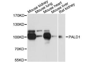 Western blot analysis of extracts of various cell lines, using PALD1 antibody.