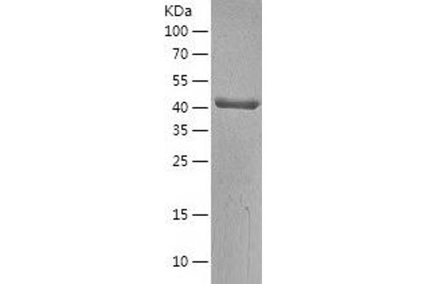 BCKDHA Protein (AA 46-445) (His tag)