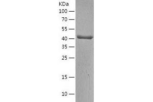 Western Blotting (WB) image for Branched Chain Keto Acid Dehydrogenase E1, alpha Polypeptide (BCKDHA) (AA 46-445) protein (His tag) (ABIN7122029)