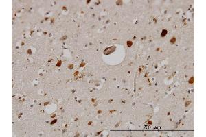 Immunoperoxidase of monoclonal antibody to PTN on formalin-fixed paraffin-embedded human cerebral cortex. (Pleiotrophin Antikörper  (AA 45-154))