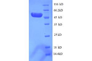 SDS-PAGE (SDS) image for PSME3 (PSME3) (AA 2-252), (partial) protein (GST tag) (ABIN5712868)