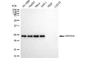 Western blotting analysis using MRPS26 antibody (ABIN7799434).