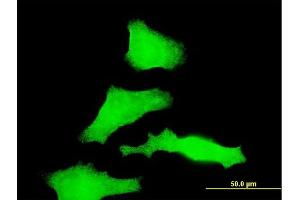 Immunofluorescence of monoclonal antibody to RAB31 on HeLa cell. (RAB31 Antikörper  (AA 96-195))