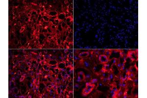 Formalin-fixed and paraffin embedded human kidney tissue labeled with Anti-Fibrinogen alpha chain Polyclonal Antibody, unconjugated  1:200, 40 minutes at 37°C. (FGA Antikörper  (AA 61-160))