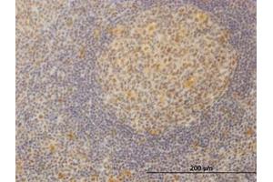 Image no. 1 for anti-Mediator Complex Subunit 21 (MED21) (AA 1-145) antibody (ABIN599079) (MED21 Antikörper  (AA 1-145))