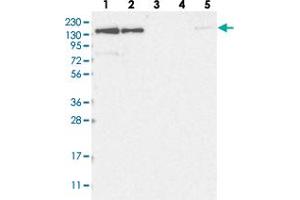 Western blot analysis of Lane 1: RT-4, Lane 2: U-251 MG, Lane 3: Human Plasma, Lane 4: Liver, Lane 5: Tonsil with NUP153 polyclonal antibody  at 1:250-1:500 dilution. (NUP153 Antikörper)