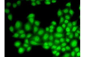 Immunofluorescence (IF) image for anti-Cullin 4B (CUL4B) antibody (ABIN1876588) (Cullin 4B Antikörper)