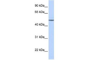 ADRB1 antibody used at 1 ug/ml to detect target protein.