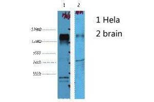 Western Blot (WB) analysis of 1) HeLa, 2) Mouse Brain, diluted at 1:4000. (ErbB2/Her2 Antikörper)