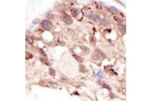 Immunohistochemistry (Paraffin-embedded Sections) (IHC (p)) image for anti-Suppressor of Variegation 3-9 Homolog 2 (Drosophila) (SUV39H2) (AA 360-390), (C-Term) antibody (ABIN388082)