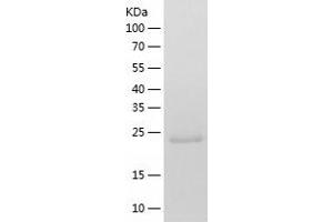 Western Blotting (WB) image for CD274 (PD-L1) (AA 19-239) protein (His tag) (ABIN7122198)