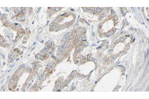 ABIN6278390 at 1/100 staining Human prostate tissue by IHC-P. (EIF3B Antikörper)
