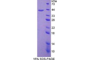 Image no. 1 for ArfGAP with Dual PH Domains 2 (ADAP2) (AA 49-360) protein (His tag) (ABIN6238039)
