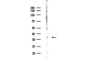 anti-Mitochondrial Ribosomal Protein L3 (MRPL3) (N-Term) antibody