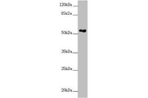 Western blot All lanes: FOXRED1 antibody at 5. (FOXRED1 Antikörper  (AA 307-486))