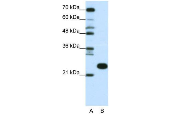 RPL13 anticorps  (C-Term)