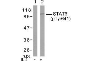 Image no. 2 for anti-Signal Transducer and Activator of Transcription 6, Interleukin-4 Induced (STAT6) (pTyr641) antibody (ABIN196701) (STAT6 Antikörper  (pTyr641))