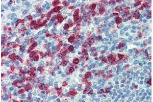 Human Spleen: Formalin-Fixed, Paraffin-Embedded (FFPE) (SELPLG Antikörper)